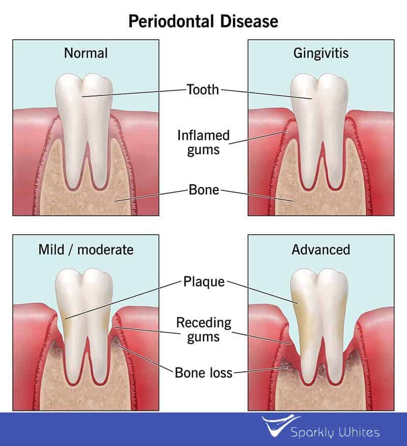 If Your Gums Could Talk, What Would They Say About Your Health Reading?