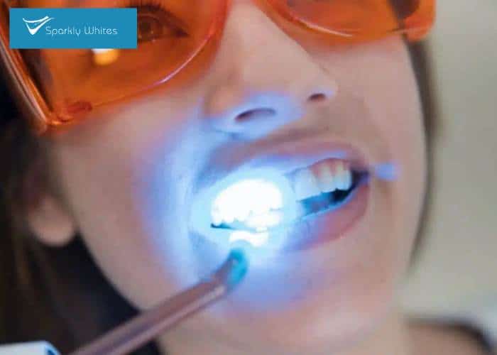 Will Whitening Make My Teeth and Dental Work Look Different Reading?